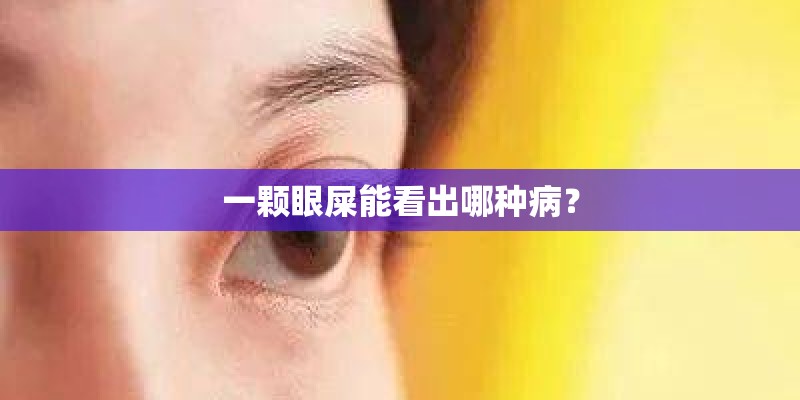 一颗眼屎能看出哪种病？